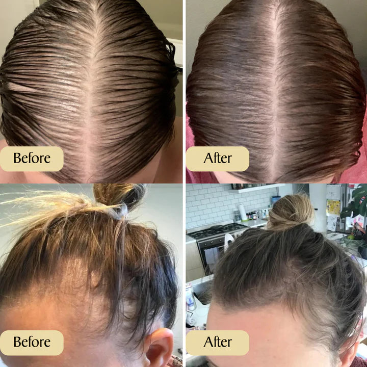 Veganic Hair Oil Before And After Results