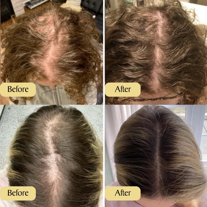 Veganic Hair Oil Before After